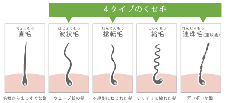 くせ毛の種類を紹介。直毛と比べた時の波状毛・捻転毛・縮毛・連珠毛（連球毛）